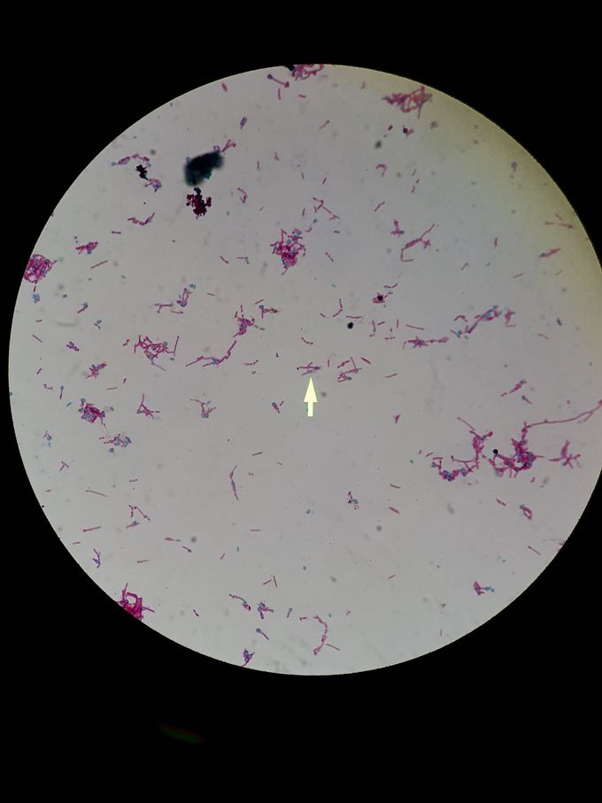 Can you guess what bacteria is on the picture?