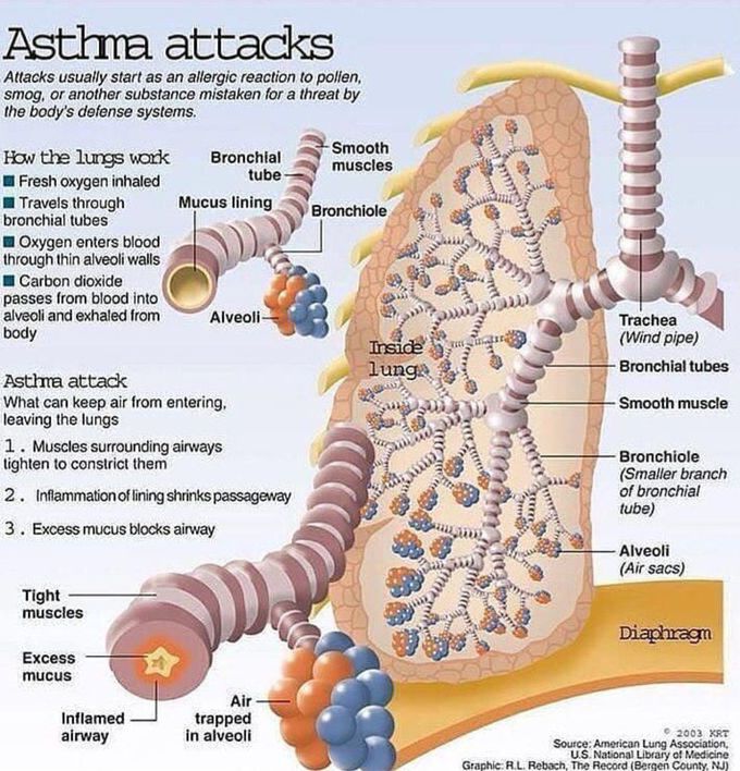 Pathophysiology