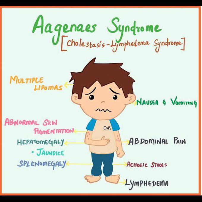 These are the symptoms of Aagenaes syndrome