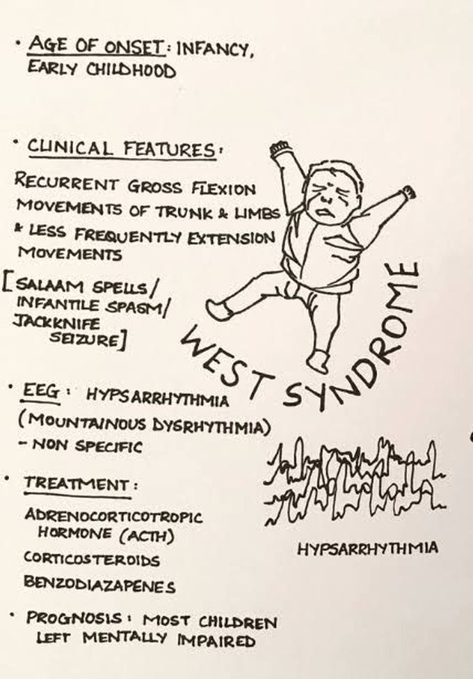 West syndrome