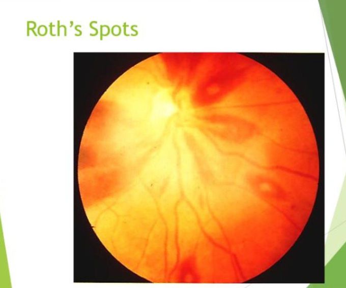 Roth's Spots