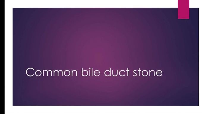 Common bile duct stone