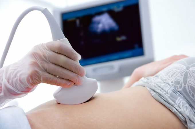 Bipolar disorder medication taken by pregnant women could risk birth defects
