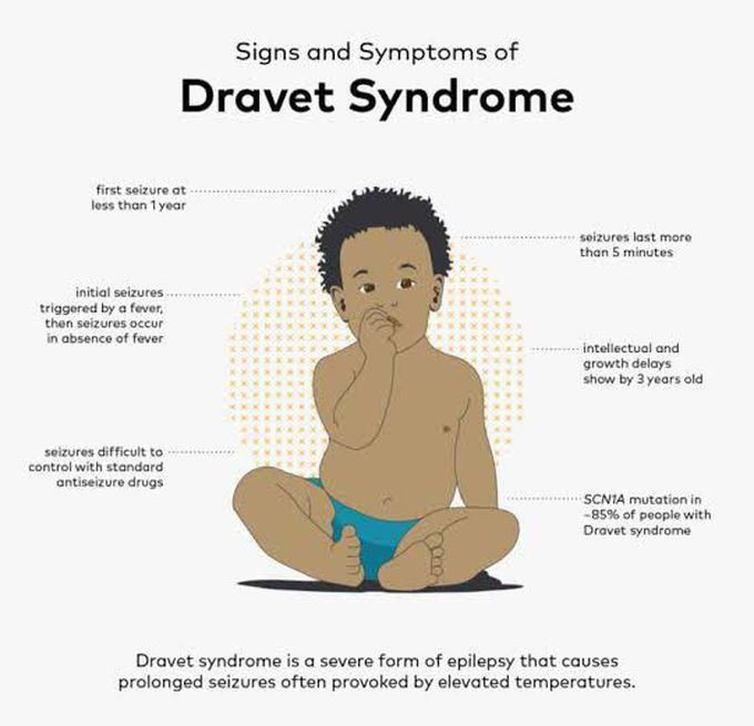 These are the symptoms of Dravet syndrome
