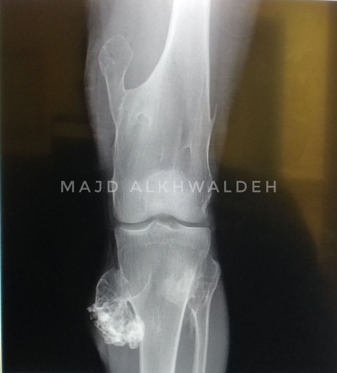 Knee x-ray