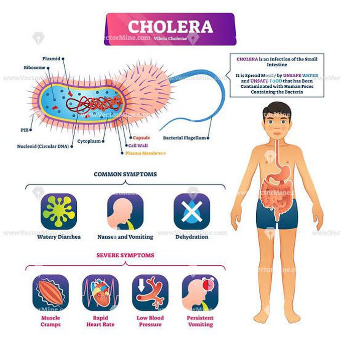 Cholera