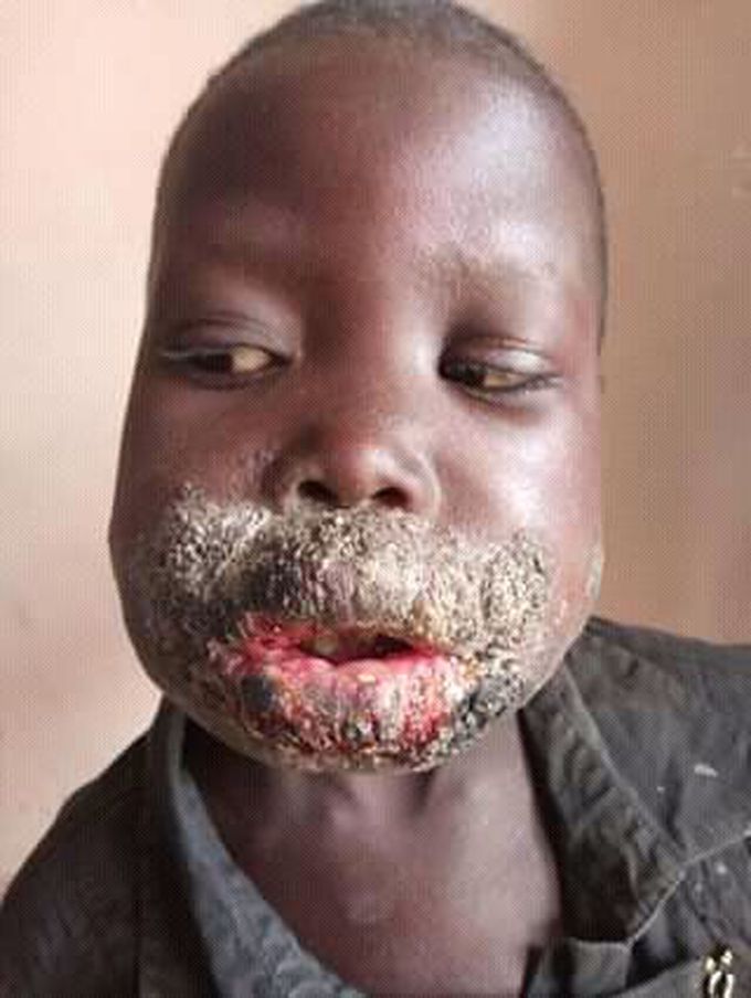 Please diagnosis and treatment