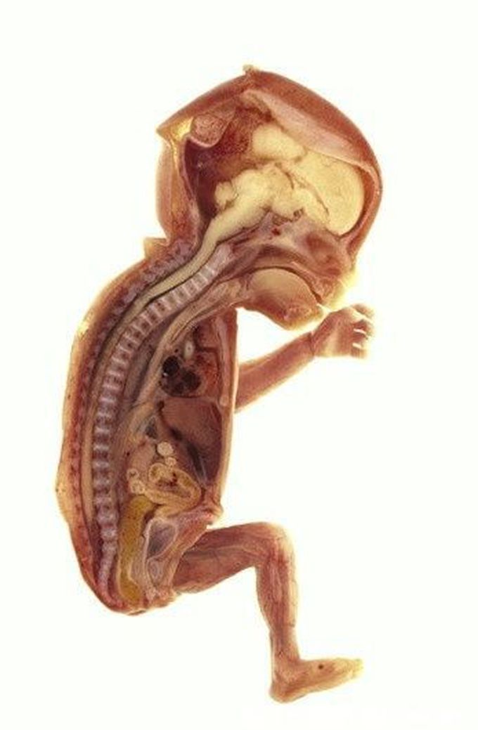 Sagittal section through foetus