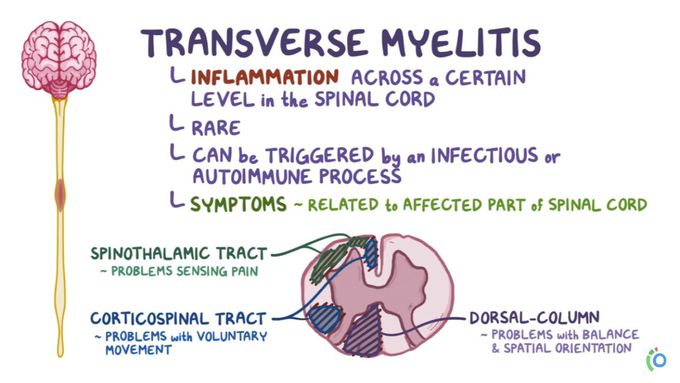 Transverse Myelitis