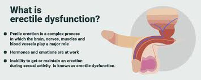 Causes of erectile dysfunction MEDizzy