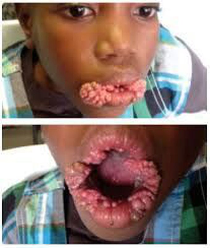 What is your diagnosis ??