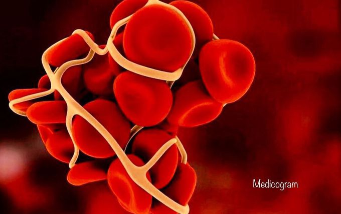 Blood clot