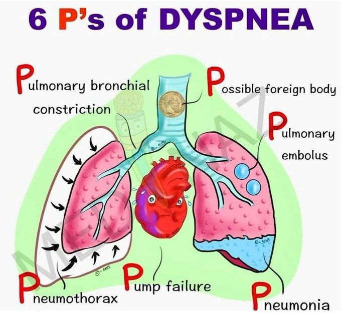 Dyspnea