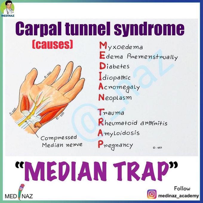 Mnemonic for carpal tunnel syndrome