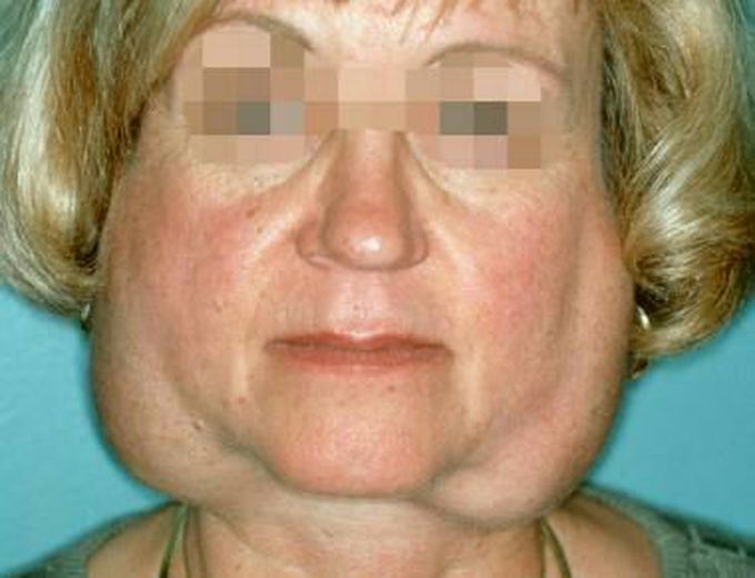 Diagnosis?