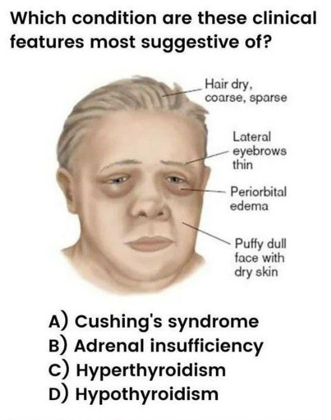 Identify the condition