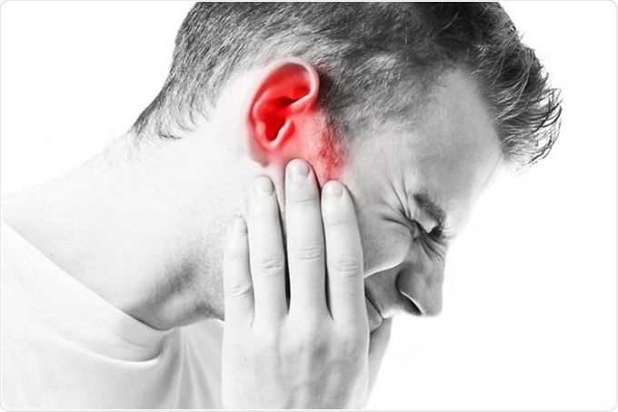 Causes of Tinnitus