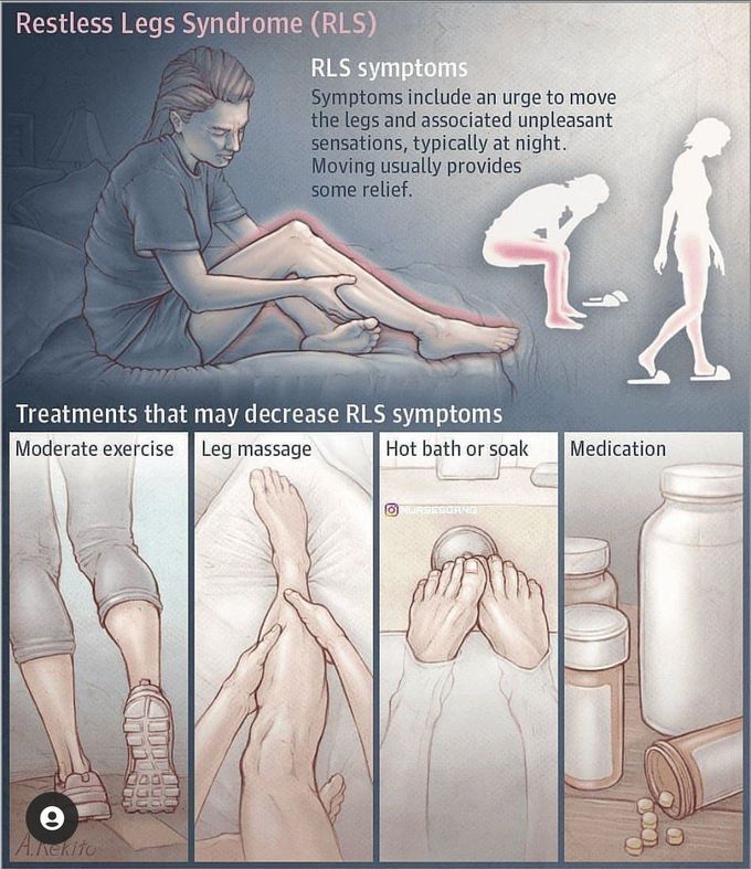 Restless leg syndrome