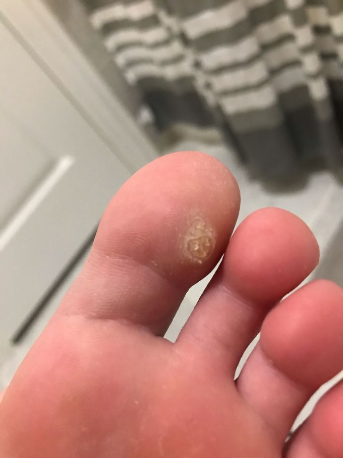 Can anyone help me with some points on how to make this shrink or get better?
