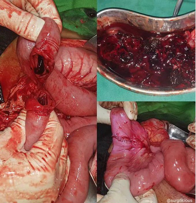 general surgery