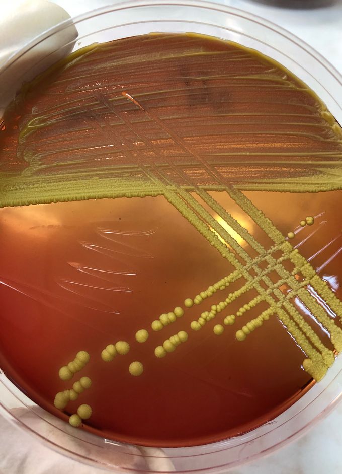 Yellow colonies of Micrococcus luteus on blood agar