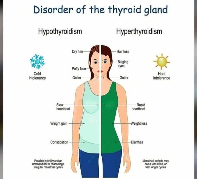 Disorders of thyroid gland