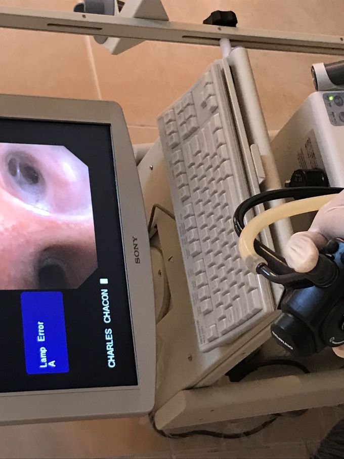 Bronchoscopy procedure