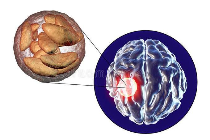 Symptoms of brain abcess