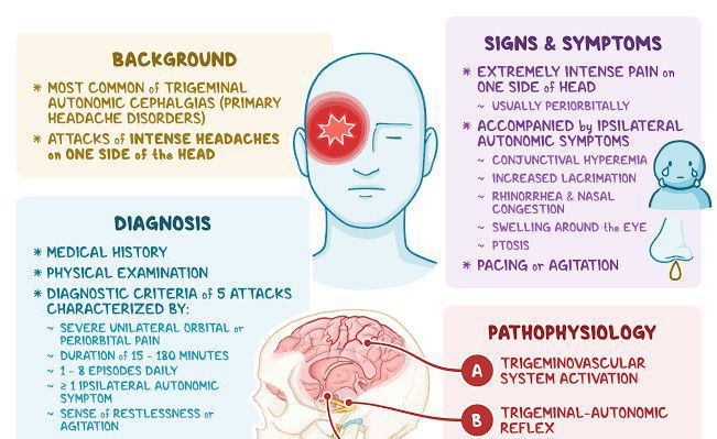 Cluster headache - MEDizzy