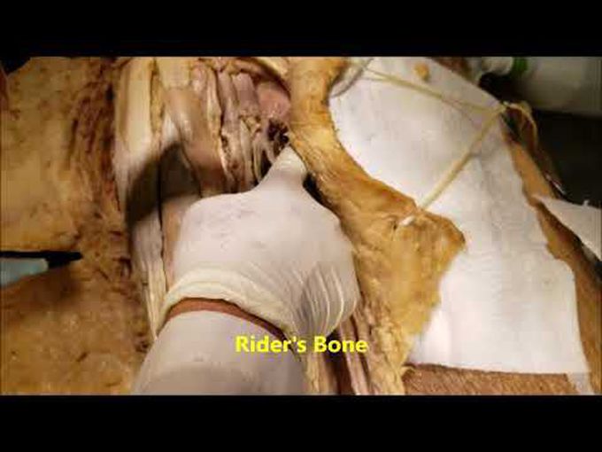 Dissection of the Medial Compartment of the Thigh.
