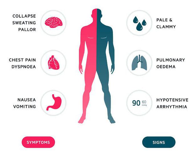 Signs and symptoms of acute coronary syndrome