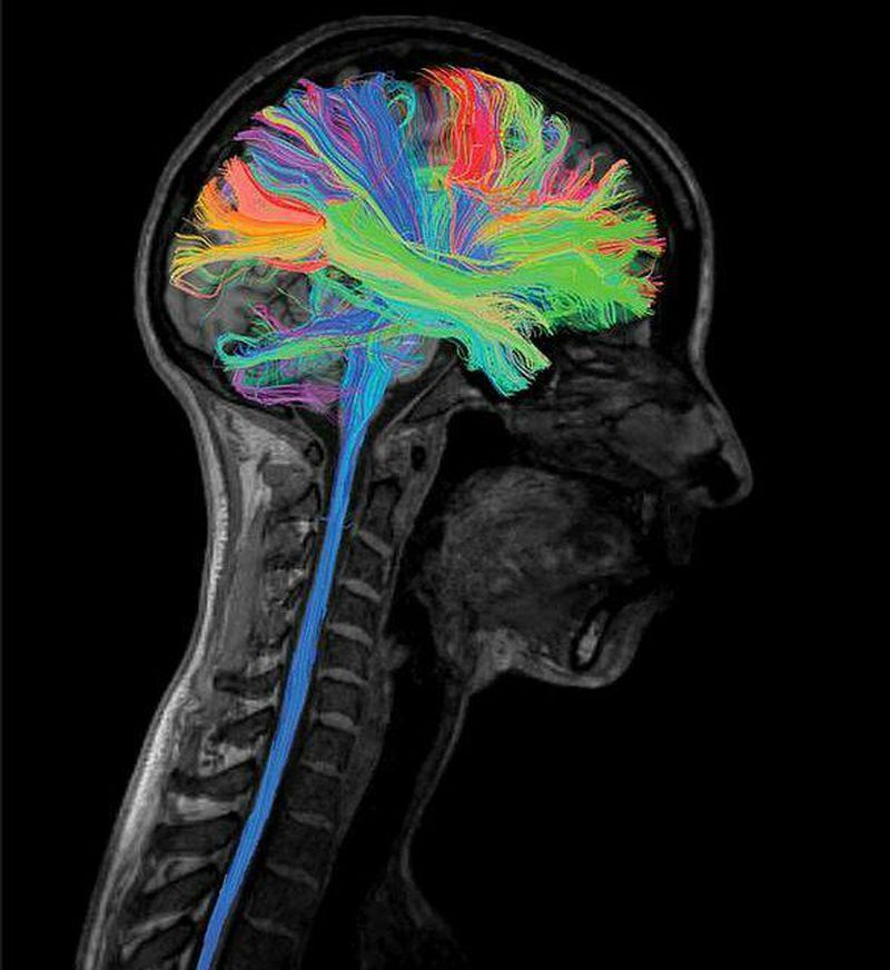 Diffusion Tensor Imaging 洋書 Introduction to Diffusion Tensor Imaging: And Higher Order Models