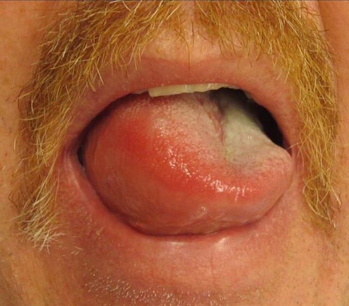 Differential Diagnosis?