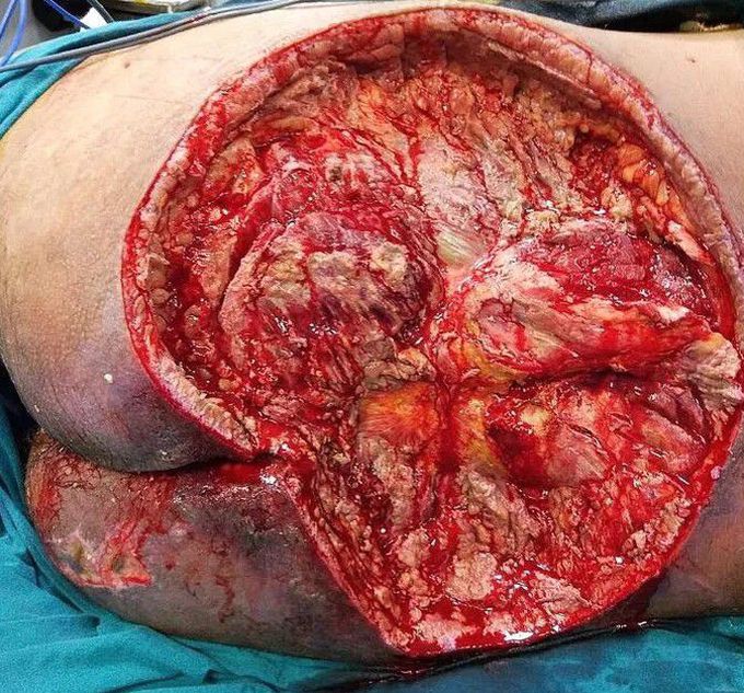 general trauma surgery