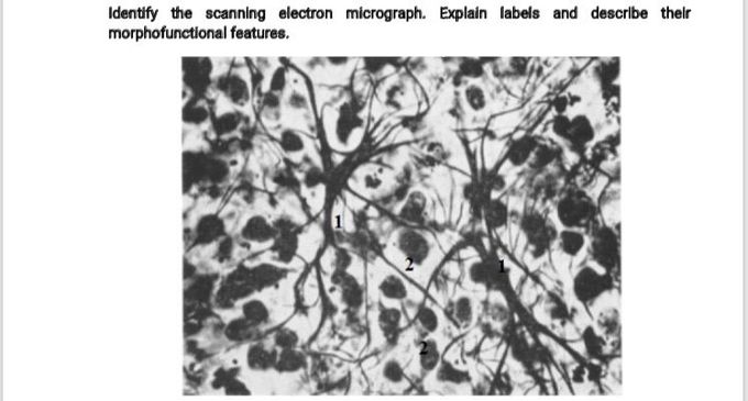 Which is the part of Histology Endocrine system