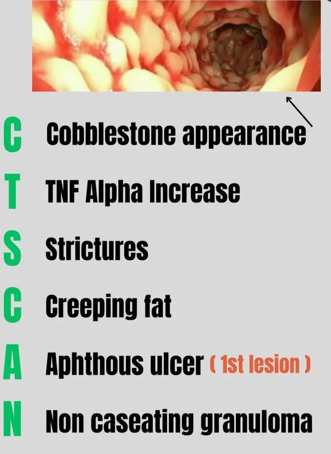 Crohn's Disease - Mnemonic