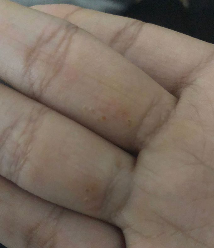 Diagnose this