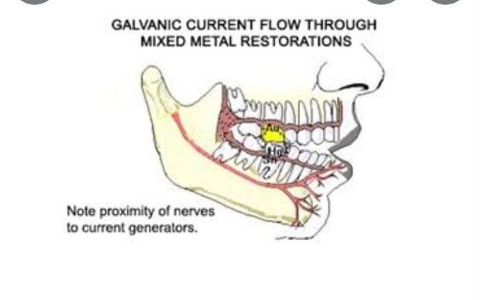 Galvanic pain