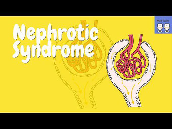 pathophysiology of nephrotic syndrome