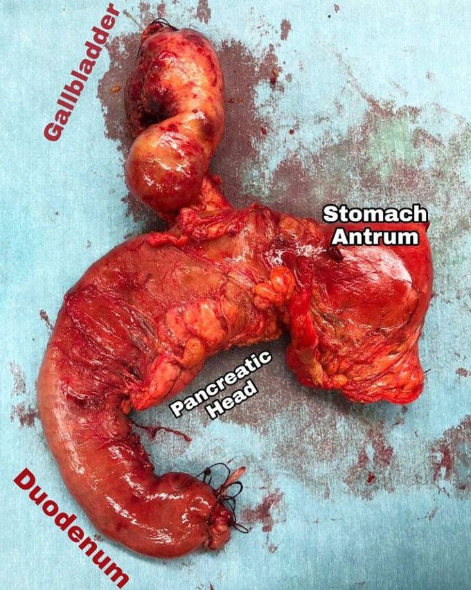 general-surgery-medizzy