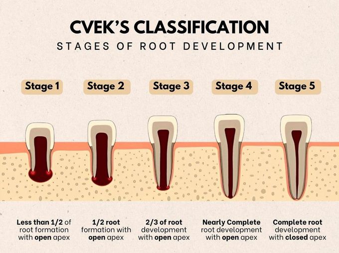 Cvek's Classification