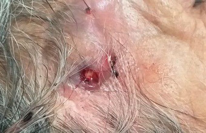 What is your diagnosis?