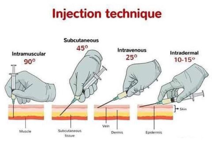 Injection Techique