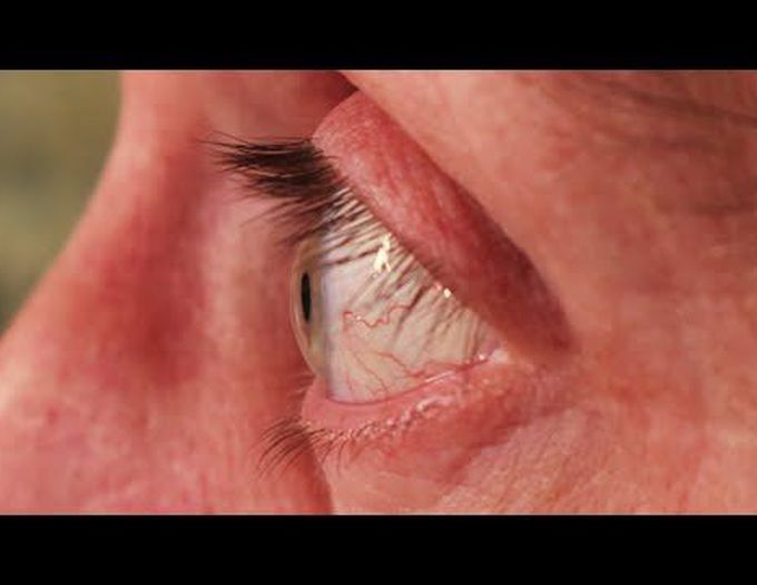 Anterior eye anatomy