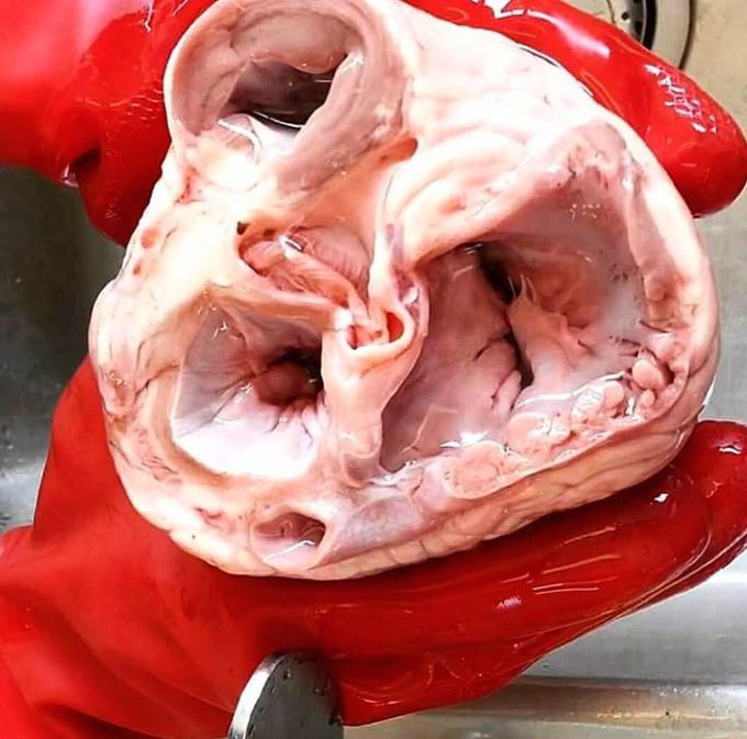 Top view into the chambers of the heart