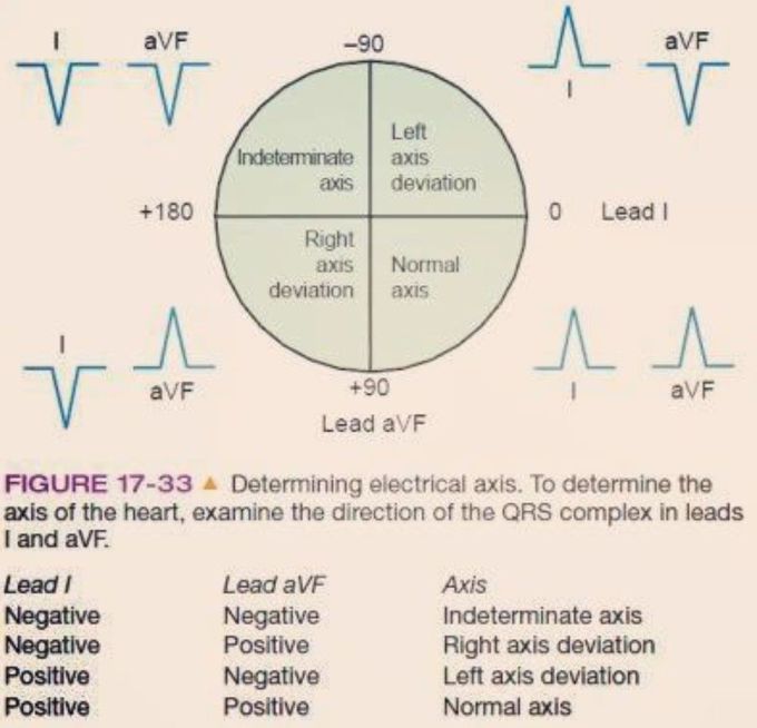 ECG Review