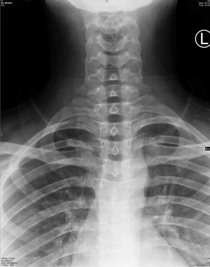 What is diagnosis