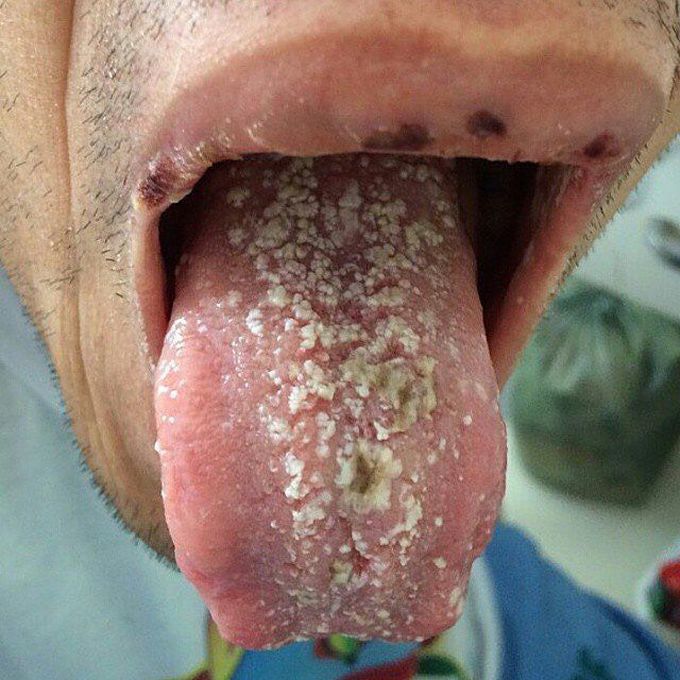 What is ur diagnosis??