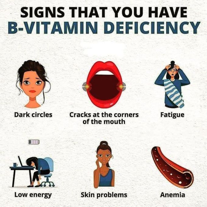 Signs that you have Vit B deficiency