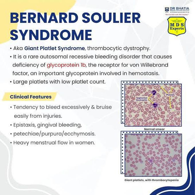 Bernard Soulier Syndrome